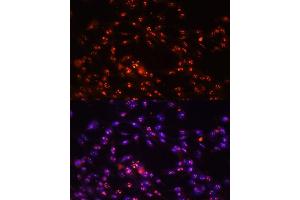 Immunofluorescence analysis of NIH-3T3 cells using DKC1 antibody (ABIN6127762, ABIN6139635, ABIN6139636 and ABIN6216722) at dilution of 1:100. (DKC1 anticorps  (AA 1-180))