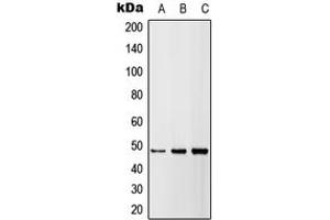 Western blot analysis of DR5 expression in HEK293T (A), A549 (B), H9C2 (C) whole cell lysates. (TNFRSF10B anticorps  (Center))