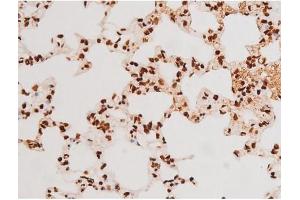 ABIN6267604 at 1/200 staining Rat lung tissue sections by IHC-P.