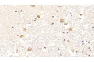 Detection of FGB in Human Cerebrum Tissue using Monoclonal Antibody to Fibrinogen Beta Chain (FGB)