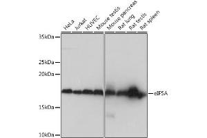 Western blot analysis of extracts of various cell lines, using eIF5A Rabbit mAb (ABIN1682900, ABIN7101685, ABIN7101686 and ABIN7101687) at 1:1000 dilution. (EIF5A anticorps)