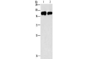 Gel: 10 % SDS-PAGE, Lysate: 40 μg, Lane 1-2: A431 cells, hela cells, Primary antibody: ABIN7191891(PIP5K1C Antibody) at dilution 1/500, Secondary antibody: Goat anti rabbit IgG at 1/8000 dilution, Exposure time: 2 minutes (PIP5K1C anticorps)