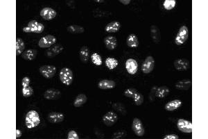 Immunofluorescent staining of HeLa cells. (Ki-67 anticorps)