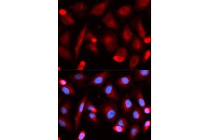 Immunofluorescence (IF) image for anti-Friend Leukemia Virus Integration 1 (FLI1) antibody (ABIN1876845) (FLI1 anticorps)