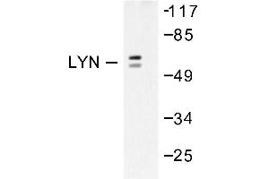 Image no. 1 for anti-V-Yes-1 Yamaguchi Sarcoma Viral Related Oncogene Homolog (LYN) antibody (ABIN271898)