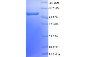 SDS-PAGE (SDS) image for Calponin 1 (CNN1) (AA 1-297), (full length) protein (His-SUMO Tag) (ABIN5709301)