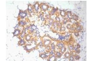 Immunohistochemistry (IHC) staining of Human ovary tissue, diluted at 1:200 (beta Actin anticorps)