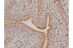 ABIN6267554 at 1/100 staining rat uterine tissue sections by IHC-P.