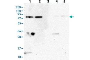 Western blot analysis of Lane 1: RT-4, Lane 2: U-251 MG, Lane 3: Human Plasma, Lane 4: Liver, Lane 5: Tonsil with WDR48 polyclonal antibody  at 1:250-1:500 dilution. (WDR48 anticorps)