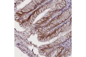 Immunohistochemical staining of human stomach with RTTN polyclonal antibody  shows moderate cytoplasmic positivity in glandular cells. (Rotatin (RTTN) anticorps)