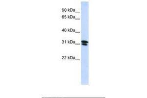 Image no. 1 for anti-Ring Finger Protein 182 (RNF182) (AA 72-121) antibody (ABIN6739169)