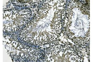 IHC analysis of XPD/ERCC2 using anti-XPD/ERCC2 antibody (ABIN7602458).