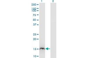 Western Blot analysis of RBP2 expression in transfected 293T cell line by RBP2 monoclonal antibody (M02), clone 3G12. (RBP2 anticorps  (AA 45-134))