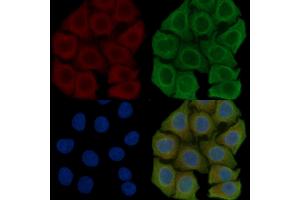 ABIN6258250 and ABIN6275386 staining Hela cells(45 min of heat-shock) by IF/ICC.