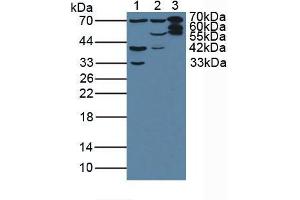 Figure. (Plastin 3 anticorps  (AA 379-630))