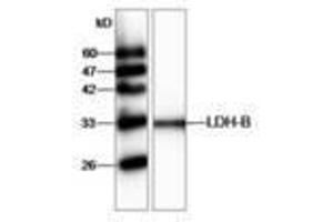 Image no. 1 for anti-Lactate Dehydrogenase B (LDHB) antibody (ABIN791438) (LDHB anticorps)