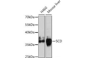Western blot analysis of extracts of various cell lines using SCD Polyclonal Antibody at dilution of 1:1000. (SCD anticorps)