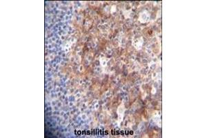 RCO Antibody (N-term) A immunohistochemistry analysis in forlin fixed and paraffin embedded hun tonsillitis tissue followed by peroxidase conjugation of the secondary antibody and DAB staining. (MARCO anticorps  (AA 13-40))