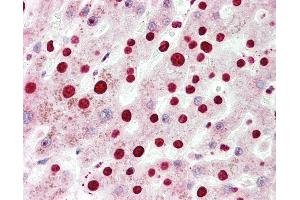 Human, Liver: Formalin-Fixed Paraffin-Embedded (FFPE).