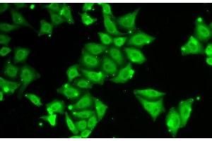 Immunofluorescence analysis of HeLa cells using Ataxin 3 Polyclonal Antibody (Ataxin 3 anticorps)