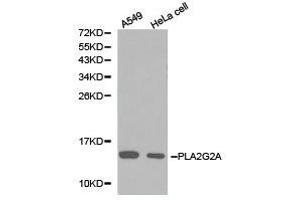 Western Blotting (WB) image for anti-Phospholipase A2, Group IIA (Platelets, Synovial Fluid) (PLA2G2A) antibody (ABIN1874153) (PLA2G2A anticorps)