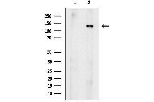 anti-Janus Kinase 2 (JAK2) (pTyr221) antibody