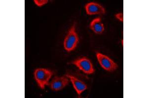 Immunofluorescent analysis of mGLUR6 staining in NIH3T3 cells.