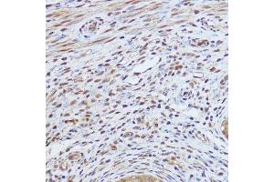 Immunohistochemistry of paraffin-embedded mouse uterus using GLI1 Rabbit pAb (ABIN7271533) at dilution of 1:150 (40x lens).