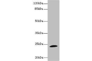 Western blot All lanes: TPPP antibody IgG at 1. (Tppp anticorps  (AA 1-219))