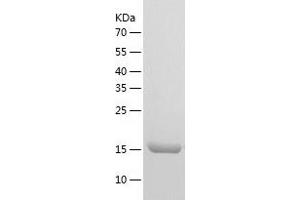 Western Blotting (WB) image for Exosome Component 1 (EXOSC1) (AA 1-195) protein (His-IF2DI Tag) (ABIN7122861)