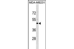 CCR5 Antibody (Center) (ABIN1881182 and ABIN2838678) western blot analysis in MDA-M cell line lysates (35 μg/lane). (CCR5 anticorps  (AA 151-177))