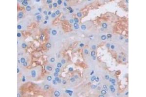 Used in DAB staining on fromalin fixed paraffin- embedded Kidney tissue (CMTM1 anticorps  (AA 1-286))