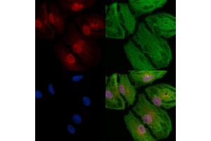 ABIN6257088 and ABIN6273791 staining  cells by IF/ICC. (CSNK2A2 anticorps  (N-Term))