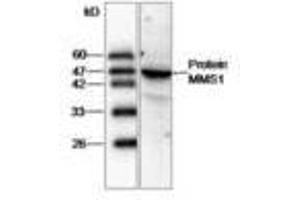 Image no. 1 for anti-Proteasome (Prosome, Macropain) 26S Subunit, ATPase, 2 (PSMC2) antibody (ABIN791429) (PSMC2 anticorps)