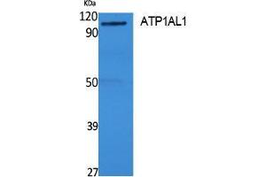 Western Blotting (WB) image for anti-ATPase, H+/K+ Transporting, Nongastric, alpha Polypeptide (ATP12A) (Internal Region) antibody (ABIN3178130) (ATP12A anticorps  (Internal Region))