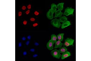 ABIN6261268 and ABIN6272941 staining Hela cells by IF/ICC.
