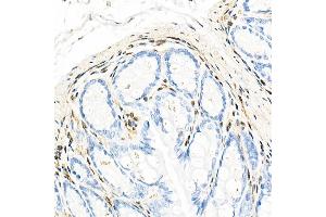 Immunohistochemistry of paraffin-embedded mouse colon using QKI Rabbit mAb (ABIN7269699) at dilution of 1:1000 (40x lens).