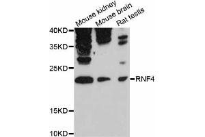 Western blot analysis of extracts of various cell lines, using RNF4 antibody (ABIN6291207) at 1:3000 dilution. (RNF4 anticorps)