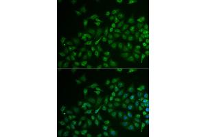 Immunofluorescence analysis of U2OS cells using MPP2 antibody (ABIN5974010). (MPP2 anticorps)