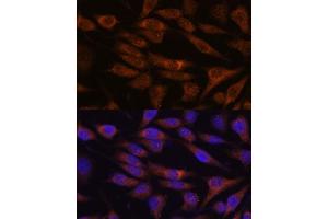 Immunofluorescence analysis of L929 cells using UNC13B antibody (ABIN7271215) at dilution of 1:100. (UNC13B anticorps  (AA 1-350))