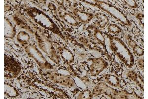 ABIN6273110 at 1/100 staining Human kidney tissue by IHC-P. (DHX9 anticorps  (C-Term))