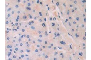 Detection of CAP1 in Human Liver Tissue using Polyclonal Antibody to Channel Activating Protease 1 (CAP1)