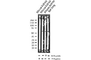 Western blot analysis of Phospho-MEF2A (Thr319) expression in various lysates (MEF2A anticorps  (pThr319))