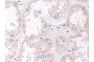 Detection of BCAR1 in Human Kidney Tissue using Polyclonal Antibody to Breast Cancer Anti-Estrogen Resistance 1 (BCAR1)