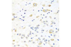 Immunohistochemistry of paraffin-embedded mouse brain using INPP5K antibody at dilution of 1:100 (x40 lens). (INPP5K anticorps)