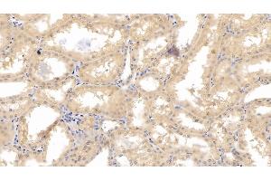 Detection of HIF1a in Human Kidney Tissue using Monoclonal Antibody to Hypoxia Inducible Factor 1 Alpha (HIF1a)