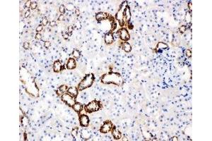 IHC-P: GLUT5 antibody testing of rat kidney tissue (SLC2A5 anticorps  (Middle Region))