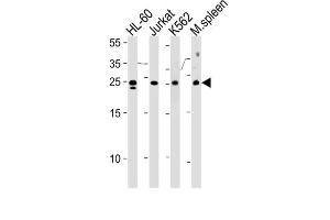 Western Blotting (WB) image for anti-Translin (TSN) antibody (ABIN2996697)