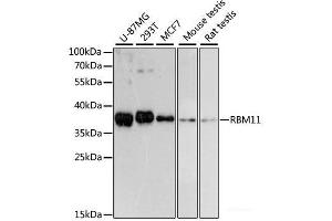 Western blot analysis of extracts of various cell lines using RBM11 Polyclonal Antibody at dilution of 1:3000. (RBM11 anticorps)