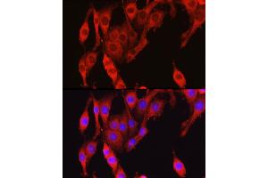 Immunofluorescence analysis of PC-12 cells using Vinculin antibody (ABIN6128911, ABIN6150070, ABIN6150071 and ABIN6218474) at dilution of 1:150. (Vinculin anticorps  (AA 767-1066))